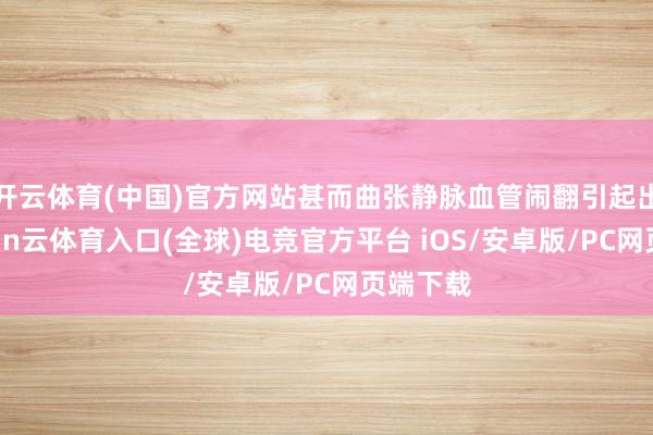 开云体育(中国)官方网站甚而曲张静脉血管闹翻引起出血-开yun云体育入口(全球)电竞官方平台 iOS/安卓版/PC网页端下载